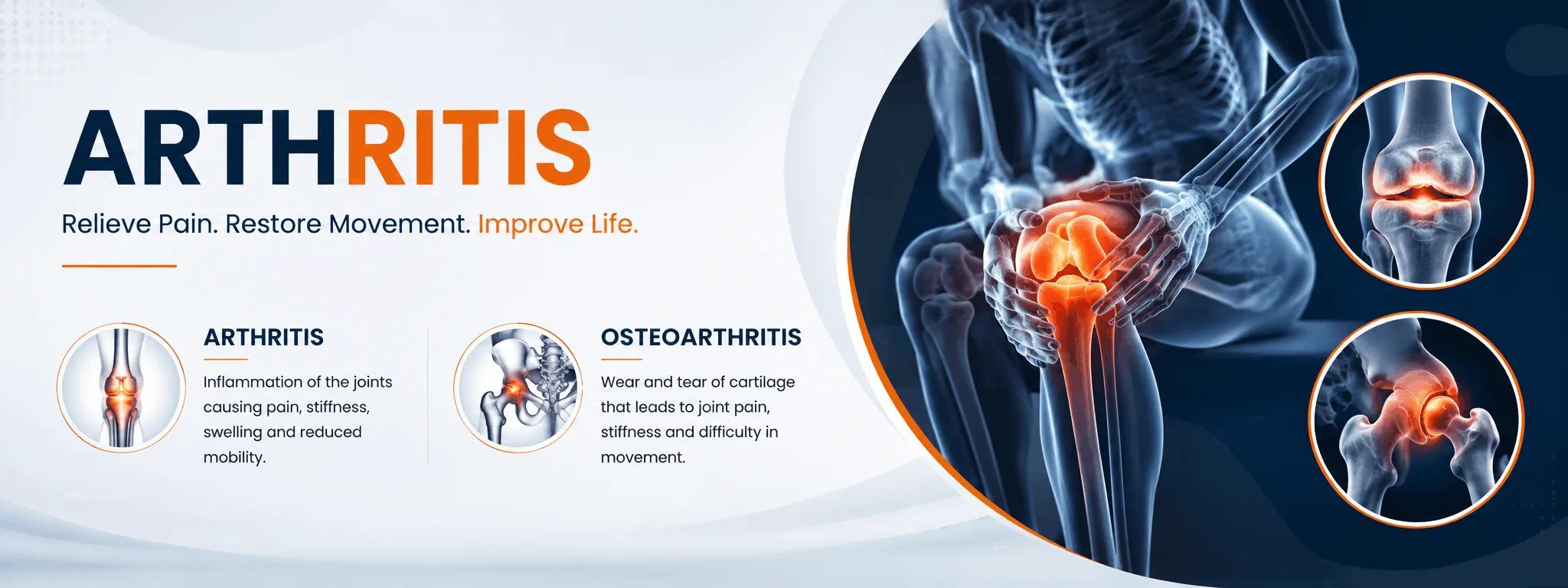 Arthritis — diagnosis and treatment in Jaipur